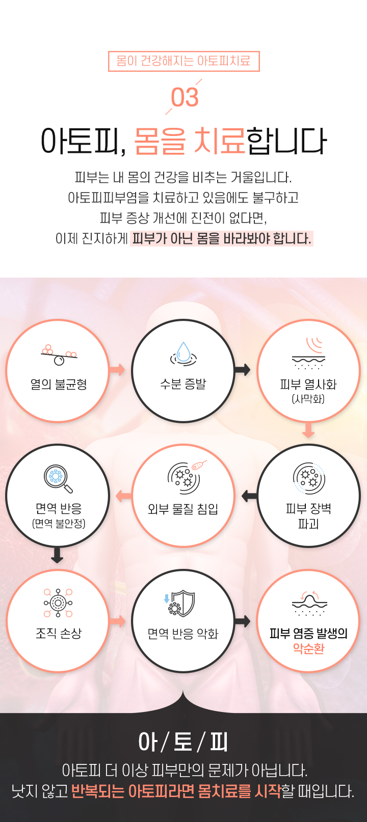 3. 아토피, 몸을 치료합니다