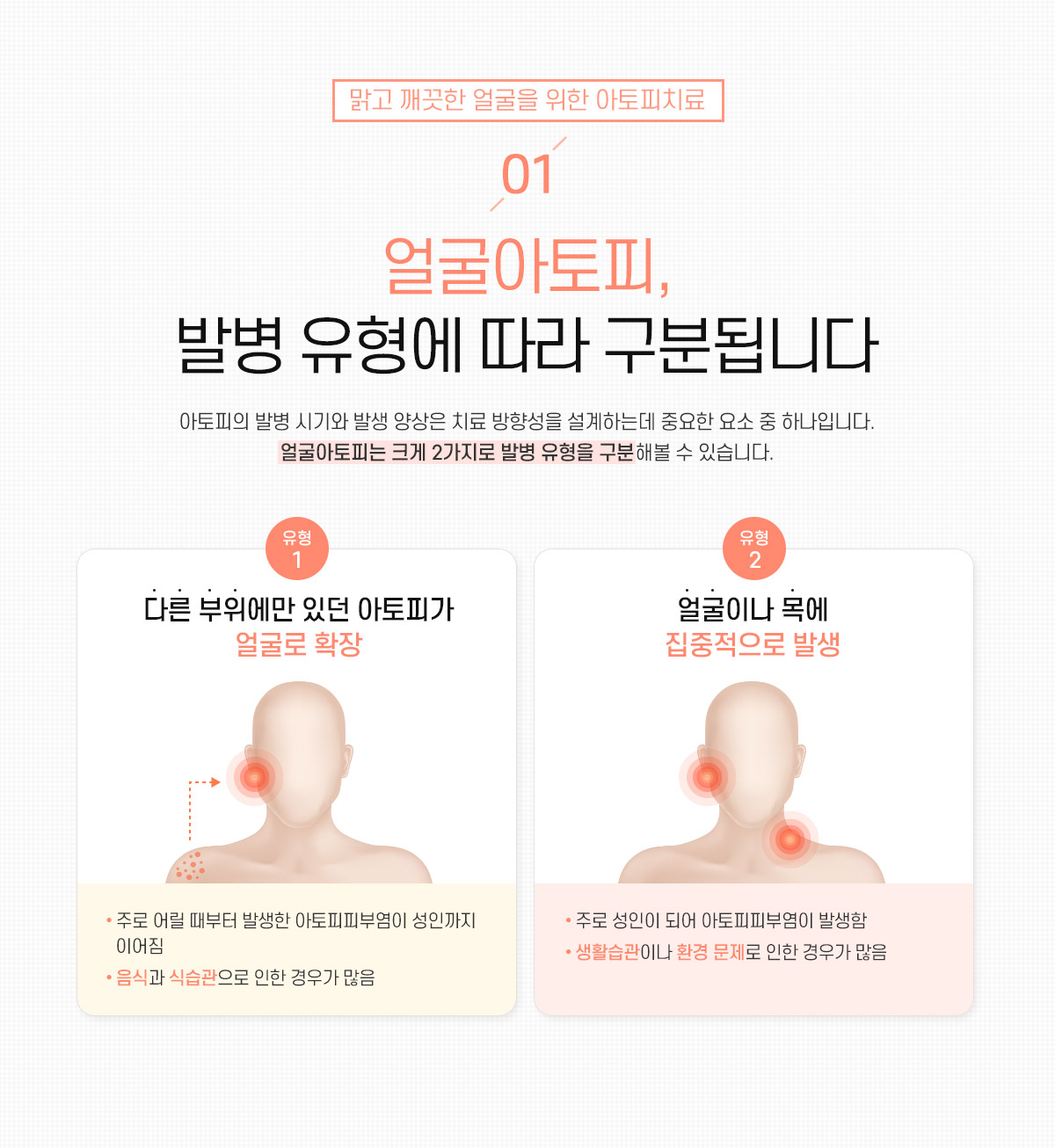 1. 얼굴아토피, 발병 유형에 따라 구분됩니다